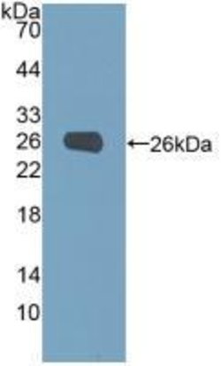 Invitrogen PGM1 Polyclonal Antibody 200 &mu;L; Unconjugated:Antibodies,