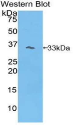 Invitrogen PIK3AP1 Polyclonal Antibody 20 &mu;L; Unconjugated:Anticuerpos
