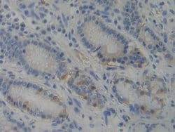 Invitrogen PIK3AP1 Polyclonal Antibody:Antibodies:Primary Antibodies
