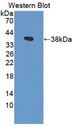Invitrogen PIK3AP1 Polyclonal Antibody:Antibodies:Primary Antibodies