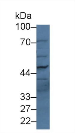 Invitrogen PLB1 Polyclonal Antibody:Antibodies:Primary Antibodies