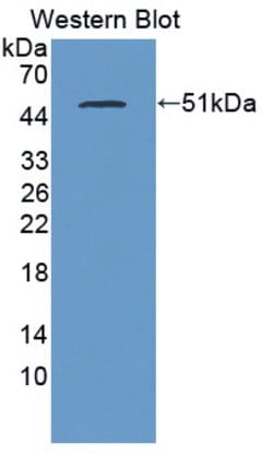 Invitrogen PLB1 Polyclonal Antibody:Antibodies:Primary Antibodies