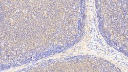 Invitrogen PLCD4 Polyclonal Antibody:Antibodies:Primary Antibodies