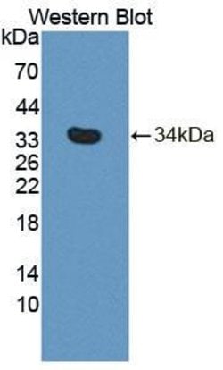 Invitrogen PLCD4 Polyclonal Antibody:Antibodies:Primary Antibodies