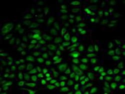 Invitrogen PSAT1 Polyclonal Antibody 20 &mu;L; Unconjugated:Antibodies,