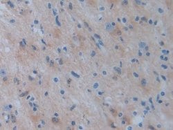 Invitrogen PSAT1 Polyclonal Antibody 20 &mu;L; Unconjugated:Antibodies,