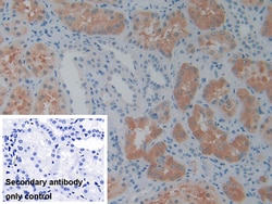 Invitrogen PSAT1 Polyclonal Antibody 20 &mu;L; Unconjugated:Antibodies,