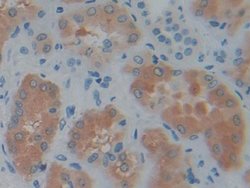 Invitrogen PSAT1 Polyclonal Antibody 20 &mu;L; Unconjugated:Antibodies,