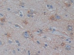 Invitrogen PSAT1 Polyclonal Antibody 20 &mu;L; Unconjugated:Antibodies,