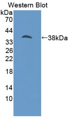 Invitrogen PSAT1 Polyclonal Antibody 20 &mu;L; Unconjugated:Antibodies,