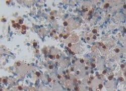Invitrogen LGALS13 Polyclonal Antibody:Antibodies:Primary Antibodies