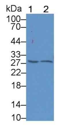 Invitrogen PAFAH1B3 Polyclonal Antibody:Antibodies:Primary Antibodies