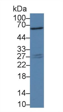 Invitrogen PAFAH1B3 Polyclonal Antibody:Antibodies:Primary Antibodies