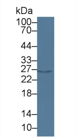 Invitrogen PAFAH1B3 Polyclonal Antibody:Antibodies:Primary Antibodies