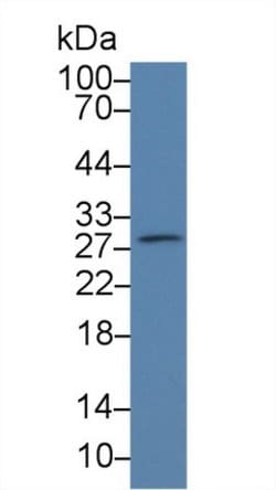 Invitrogen PAFAH1B3 Polyclonal Antibody:Antibodies:Primary Antibodies