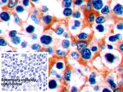 Invitrogen PD-1 Polyclonal Antibody 200 &mu;L; Unconjugated:Antibodies,