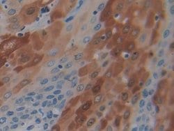 Invitrogen PD-1 Polyclonal Antibody 200 &mu;L; Unconjugated:Antibodies,