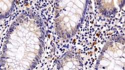 Invitrogen PD-1 Polyclonal Antibody 200 &mu;L; Unconjugated:Antibodies,