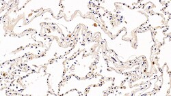 Invitrogen PD-1 Polyclonal Antibody 200 &mu;L; Unconjugated:Antibodies,