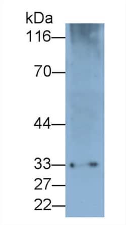 Invitrogen PD-1 Polyclonal Antibody 200 &mu;L; Unconjugated:Antibodies,