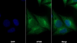 Invitrogen Prohibitin Polyclonal Antibody 200 &mu;L; Unconjugated:Antibodies,