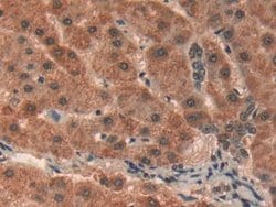 Invitrogen Prohibitin Polyclonal Antibody 200 &mu;L; Unconjugated:Antibodies,