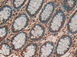 Invitrogen Prohibitin Polyclonal Antibody 200 &mu;L; Unconjugated:Antibodies,