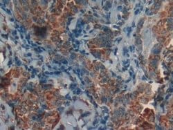 Invitrogen Prohibitin Polyclonal Antibody 200 &mu;L; Unconjugated:Antibodies,