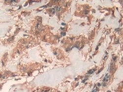 Invitrogen Prohibitin Polyclonal Antibody 200 &mu;L; Unconjugated:Antibodies,