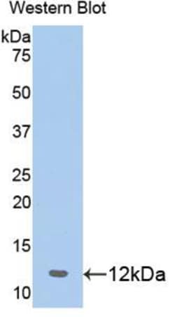Invitrogen Prohibitin Polyclonal Antibody 200 &mu;L; Unconjugated:Antibodies,
