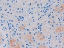 Invitrogen GCDFP-15 Polyclonal Antibody:Antibodies:Primary Antibodies