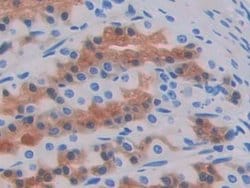 Invitrogen GCDFP-15 Polyclonal Antibody:Antibodies:Primary Antibodies