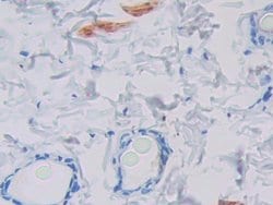 Invitrogen GCDFP-15 Polyclonal Antibody:Antibodies:Primary Antibodies