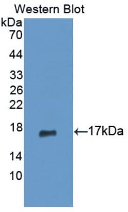 Invitrogen GCDFP-15 Polyclonal Antibody:Antibodies:Primary Antibodies