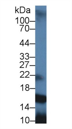 Invitrogen GCDFP-15 Polyclonal Antibody 20 &mu;L; Unconjugated:Antibodies,