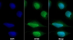 Invitrogen PSMC1 Polyclonal Antibody:Antibodies:Primary Antibodies
