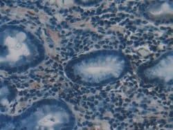 Invitrogen PSMC1 Polyclonal Antibody:Antibodies:Primary Antibodies
