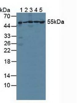 Invitrogen PSMC1 Polyclonal Antibody:Antibodies:Primary Antibodies