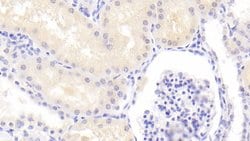 Invitrogen PSMD6 Polyclonal Antibody:Antibodies:Primary Antibodies
