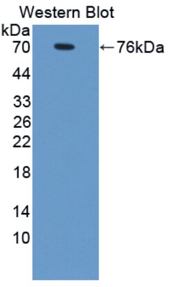 Invitrogen PSMD6 Polyclonal Antibody:Antibodies:Primary Antibodies