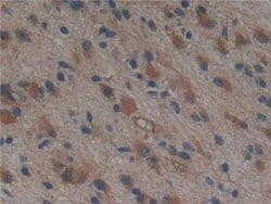Invitrogen PSMD9 Polyclonal Antibody 200 &mu;L; Unconjugated:Antibodies,