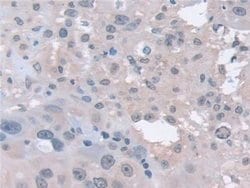Invitrogen PSMA5 Polyclonal Antibody:Antibodies:Primary Antibodies