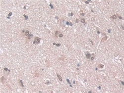 Invitrogen PSMA5 Polyclonal Antibody:Antibodies:Primary Antibodies