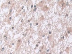 Invitrogen PSMA5 Polyclonal Antibody:Antibodies:Primary Antibodies