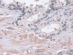 Invitrogen PSMA5 Polyclonal Antibody:Antibodies:Primary Antibodies