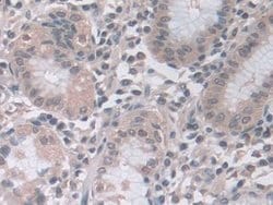 Invitrogen PSMA5 Polyclonal Antibody:Antibodies:Primary Antibodies
