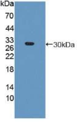 Invitrogen PSMA5 Polyclonal Antibody:Antibodies:Primary Antibodies