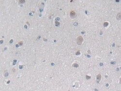 Invitrogen PSMB6 Polyclonal Antibody 200 &mu;L; Unconjugated:Antibodies,