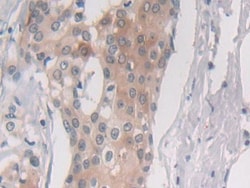 Invitrogen PSMB6 Polyclonal Antibody 20 &mu;L; Unconjugated:Antibodies,