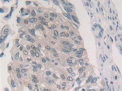 Invitrogen PSMB6 Polyclonal Antibody 200 &mu;L; Unconjugated:Antibodies,